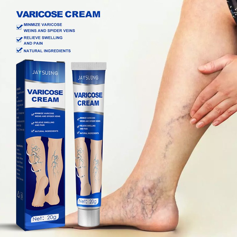 ✨¡Dile adiós a las molestias de las venas varicosas con nuestra Crema Especializada para Venas Varicosas y Arañas Vasculares!
