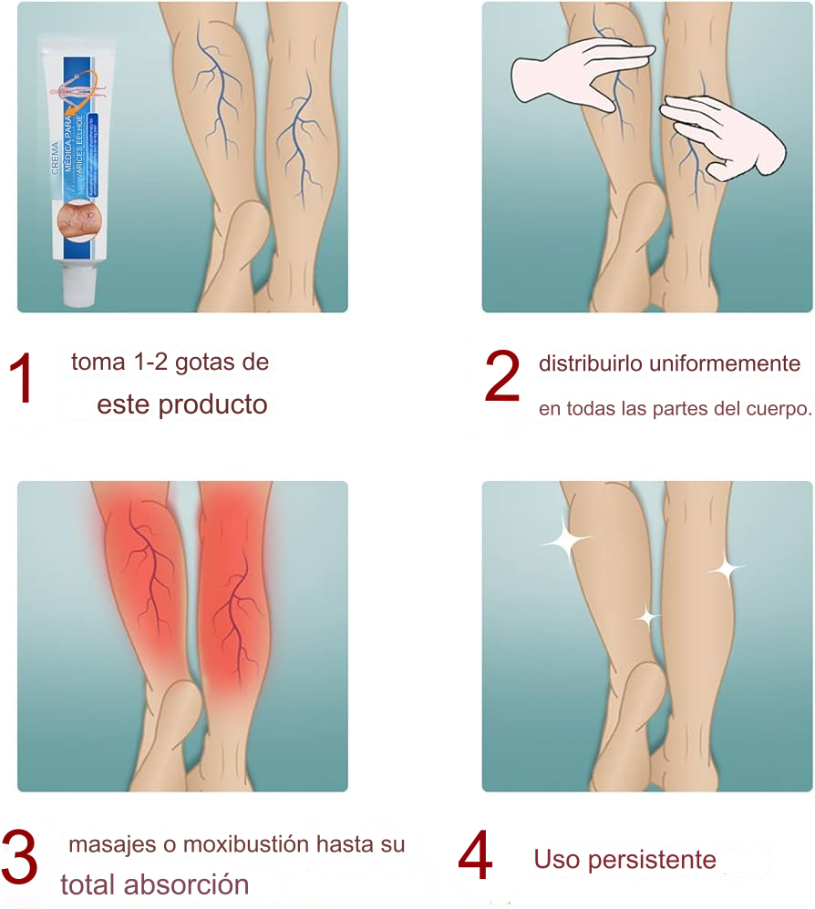 ✨¡Dile adiós a las molestias de las venas varicosas con nuestra Crema Especializada para Venas Varicosas y Arañas Vasculares!
