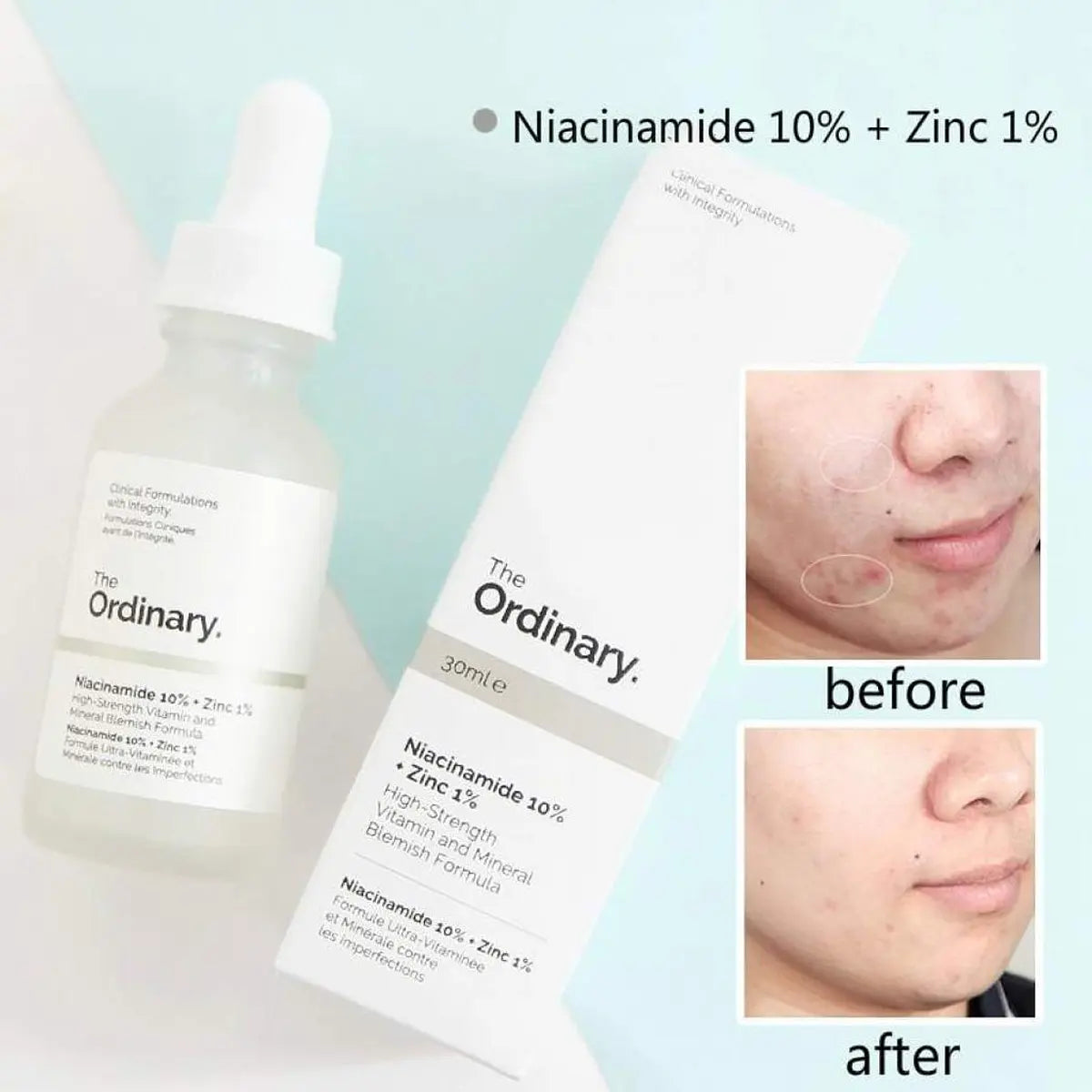 🌟Transforma tu piel con el poder de la Niacinamida (Vitamina B3)🌟