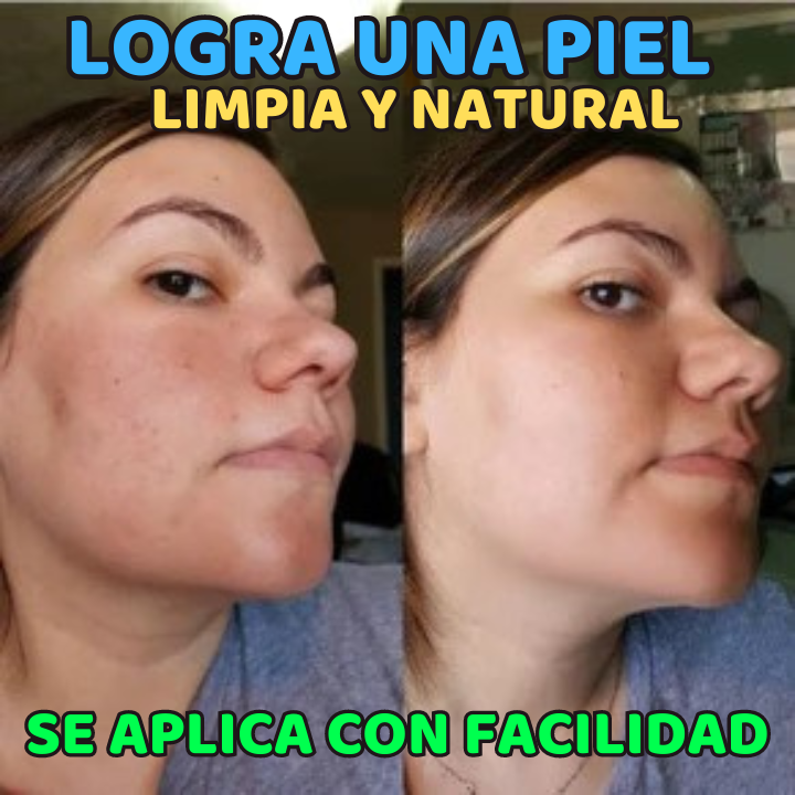 Crema Aclarante Bioqua