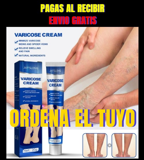 ✨¡Dile adiós a las molestias de las venas varicosas con nuestra Crema Especializada para Venas Varicosas y Arañas Vasculares!
