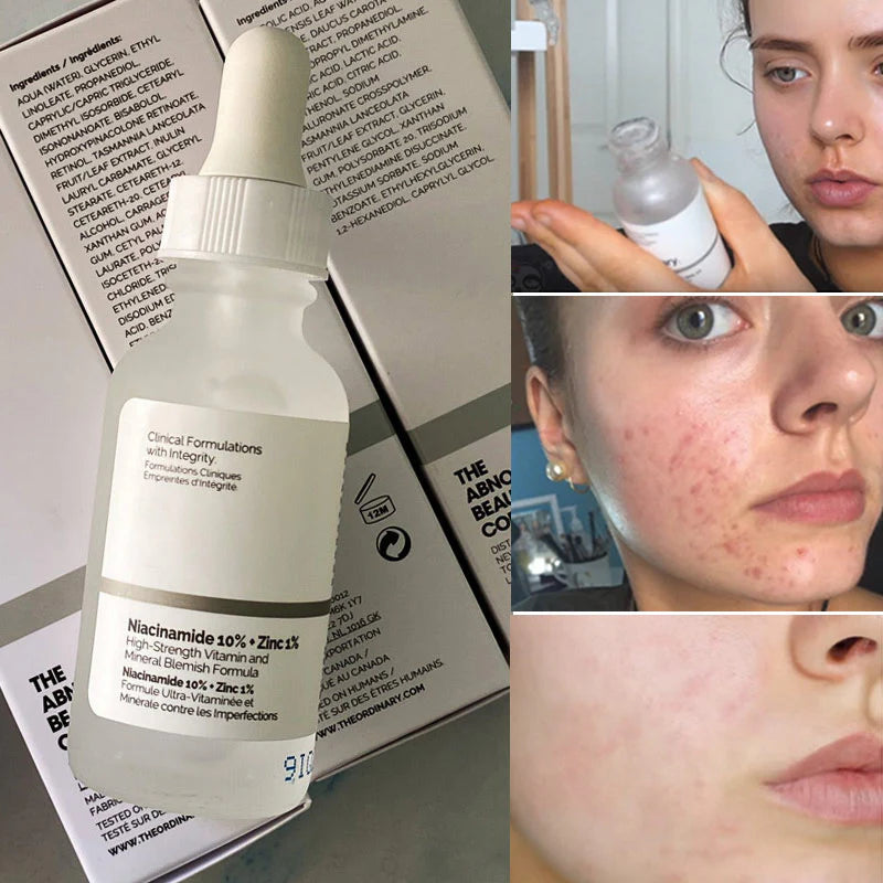 🌟Transforma tu piel con el poder de la Niacinamida (Vitamina B3)🌟